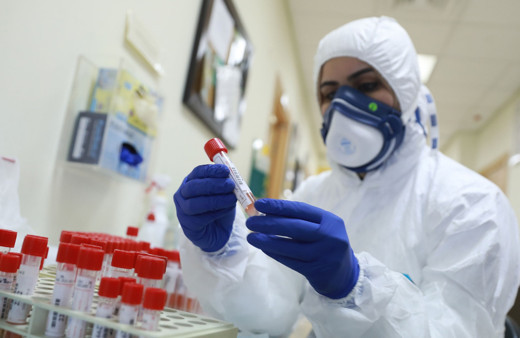 Kovid 19'u hafif geçirdiğimizi nasıl anlarız? Uzman doktordan açıklama