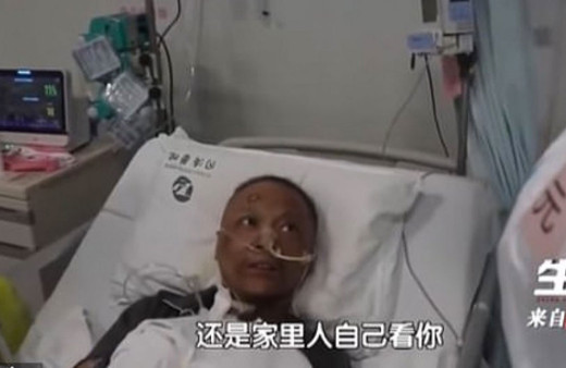 Koronavirüsü yenen iki doktor renk değiştirdi! Dünya şokta tüm hastalarda olacak mı