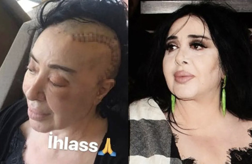 Nur Yerlitaş aslen nereli kaç yaşında öldü bilinmeyen hayatı