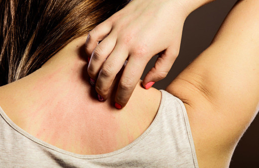 Vücudun verdiği bu sinyallere dikkat eğer sebepsiz morluklar varsa...