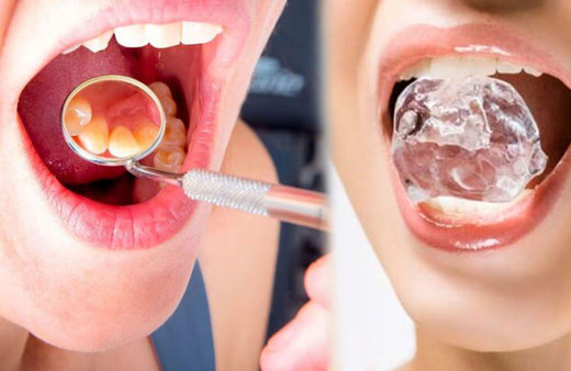 Damak yarasına ne iyi gelir buz yöntemini deneyin!