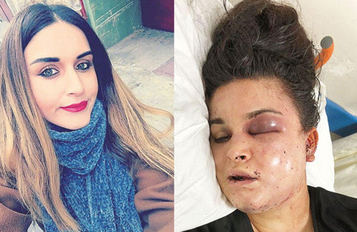 İstanbul'da kadını ormana kaldırdılar, sandalyeye oturtup işkence ettiler