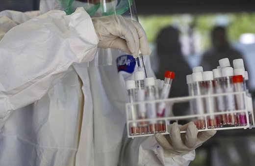 Tanzanya'da keçinin Kovid-19 testinin pozitif çıktığını açıklayan Devlet Başkanına tepki