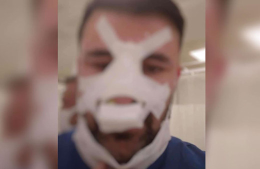 Bayram günü sağlık çalışanının burnunu kırdı, serbest kaldı