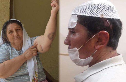 Aydın'da anne ve zihinsel engelli oğluna darp iddiası: Beni yarı çıplak bıraktı..