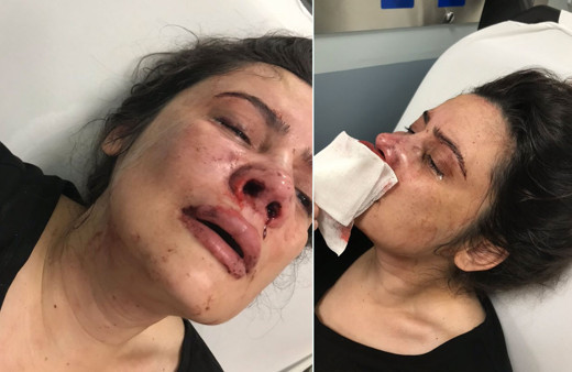 Hira Elbasan'ın anne çığlığı! Boşanmak isteyen eşini feci bir şekilde dövdü silah çekti