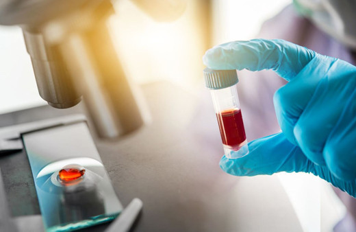 Koronavirüs hastalarının sadece yüzde 10’u antikor geliştiriyor