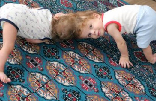 Siyam ikizleri Derman ve Yiğit Türkiye'ye getirildi