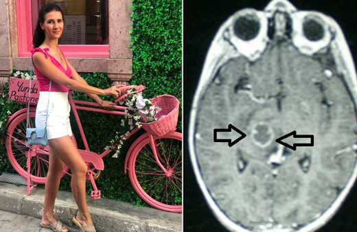 13 yaşında beyin pili takılan Pelin Köroğlu 16 yıldır böyle yaşıyor