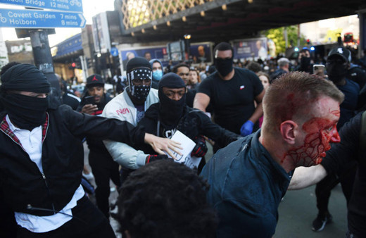 İngiltere siyahi protestocuyu konuşuyor! Darp edilen aşırı sağcıyı kurtardı