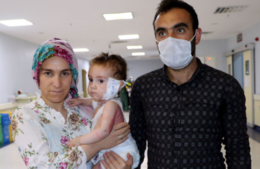 Van'da süt kazanına düşen Nurullah bebekten iyi haber geldi!