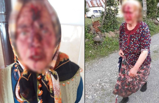 Tartıştığı yengesini baltayla başından yaraladı