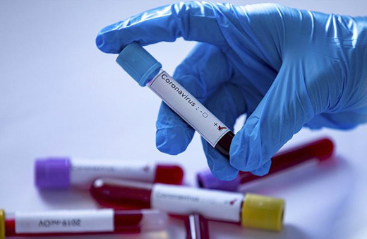 ABD’de el dezenfektanı içen 3 kişi öldü, 1 kişi kör oldu