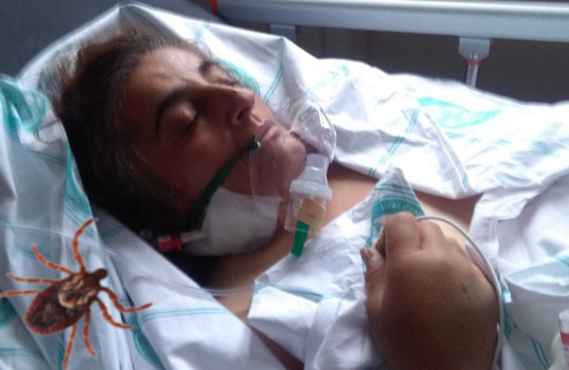 Sivas'ta bacağındaki keneyi kopardı yoğun bakımlık oldu