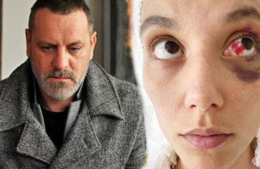 Sevgilisine korkunç şeyler yapmış! Deniz Bulutsuz'un darp raporu ortaya çıktı