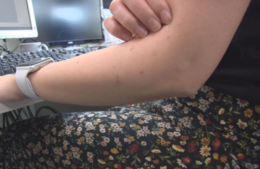 İstanbul'a sivrisinek kabusu: İlaçlara karşı direnç kazandı