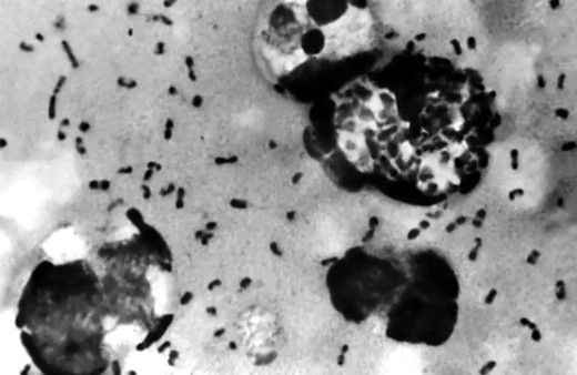 DSÖ'den 'hıyarcıklı veba hastalığı' açıklaması!