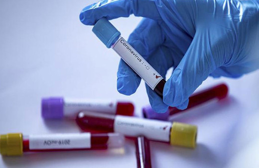 İstanbul İl Sağlık Müdürlüğü'nde Covid-19 ölümü