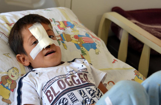 Ağrı'da küçük Bünyamin'in hayatı karardı sokak köpeğinin saldırısına uğradı