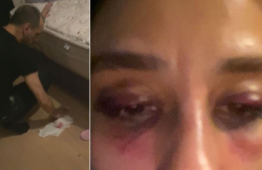 RUBATO'nun solisti Özer Arkun sevgilisini dövdü kan izlerini sildiği görüntüler ortaya çıktı