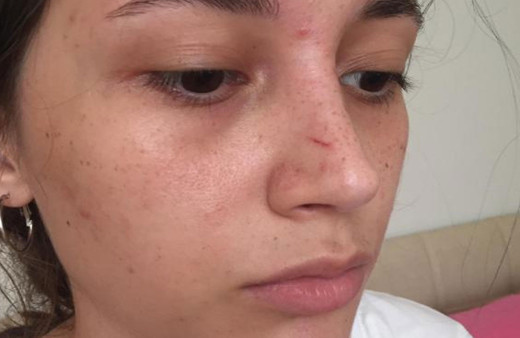 ODTÜ'lü Beril şort giydiği için darp edildi: Çığlık atarak kurtuldum