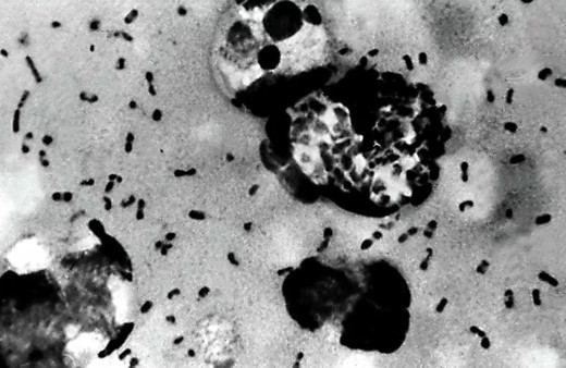 Colorado'da 2015'ten bu yana ilk veba vakası görüldü