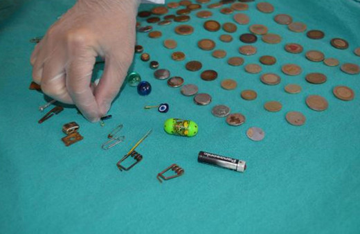 Çocukların yuttuğu şeylere bakın! Elazığ'da hastanede sergilendi