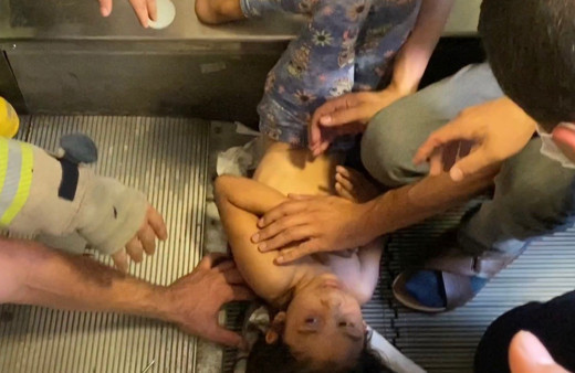 Kartal'da yürüyen merdiven saçını yuttu