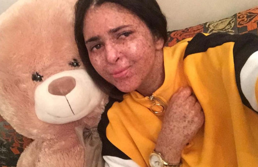 Fas'ta 20 yıldır güneş yüzü görmedi! Nadir görülen hastalık sebep oldu