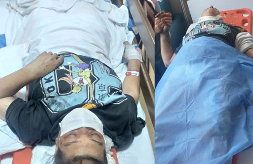 İkitelli metro istasyonunda dehşeti yaşadı! Merdiven çöktü içine düştü