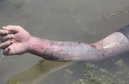 Adana'da gölde bulunan cesedin kimliği dövmesinden belirlendi