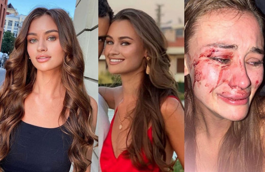 Şeyma Subaşı'nın arkadaşı Çeşme'de Daria Kyryliuk saldırıya uğradı!