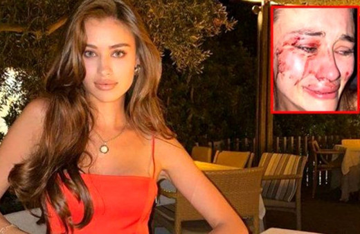 Ukraynalı model dövülmüştü: 6 eğlence mekanı kapatıldı!