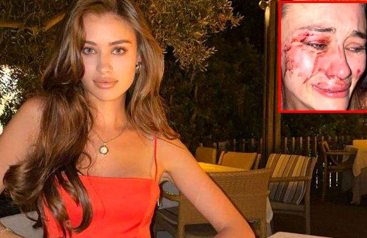 Ünlü modeli sevgilisi mi dövdü? İşte sürpriz tanığın ifadesi