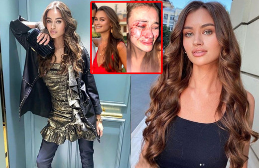 Daria Kyryliuk'un gördüğü şiddetin görüntüleri olay! İddiaları reddetti