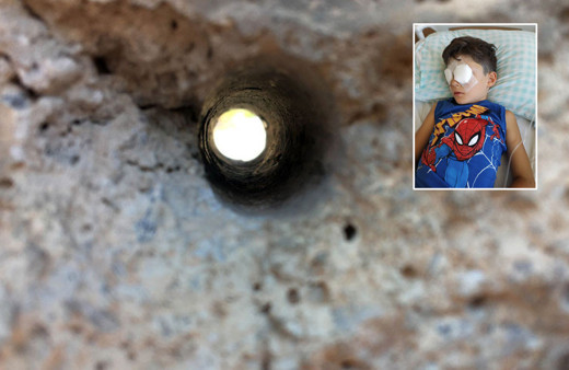 Konya'da merak edip duvar deliğinden bakan Arda gözlerinden oldu