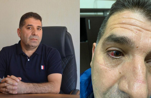 İzmir'de darp edilen Ak Partili Meclis Üyesi'nden olay iddia! Belediye başkanı yaptırdı