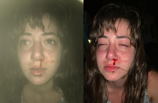 Ayvalık'ta eğlence mekânında anne ve kızına darp iddiası!