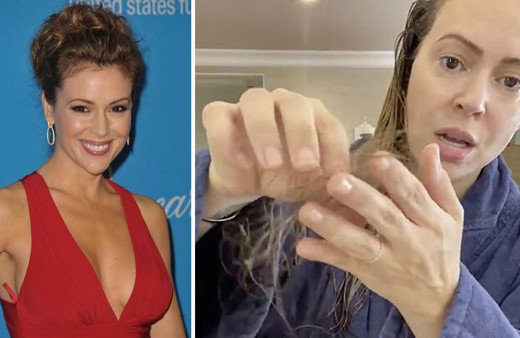 Koronaya yakalanan ünlü oyuncudan şok video! 'Covid-19 yüzünden saçlarım dökülüyor...'