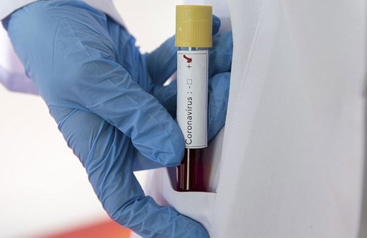 Van Valiliği'nden Covid-19 testi dolandırıcılığı uyarısı: İhbar edin