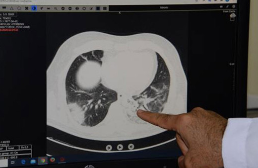 Pandemi hastanesindeki doktor Hakan Akelma: Tanık olduklarımı gören biri evden dışarı çıkmazdı