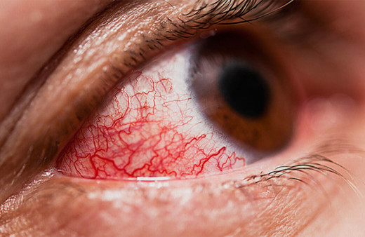 Koronavirüsün cildinizde neden olabileceği semptomlar