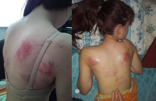 Telefon şifresini söylemeyen kızına dehşeti yaşattı