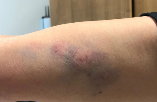 Artvin'de COVİD-19 hastası "Bana bakmak zorundasın" diyerek hekime saldırdı