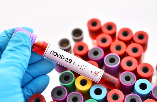 Koronavirüs vakaları çok çılgın bir şekilde artacak okulların açılması erken