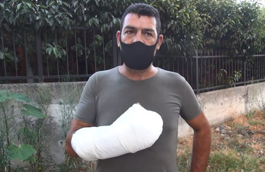 Esenyurt'ta 'Doktor kapıyı üzerime kapattı, parmaklarım koptu' diyerek şikayetçi oldu