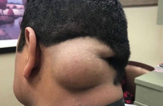 17 yıl boyunca kafasında bu hayvanla yaşadı! Doktora gitti aldığı yanıt şoka uğrattı