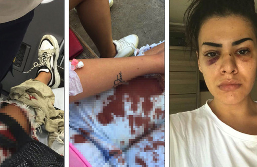 Nagehan Bıyıklı'ya önce taciz sonra darp: Korkudan eve gidemiyorum