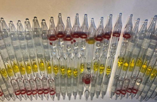 Değeri 6 milyondan fazla! Edirne'de 230 tüp kobra yılanı zehri ele geçti