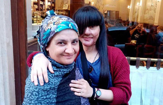 Yüzünü asitle yakan sevgilisini affeden Berfin Özek: Bunu nasıl yapabildim